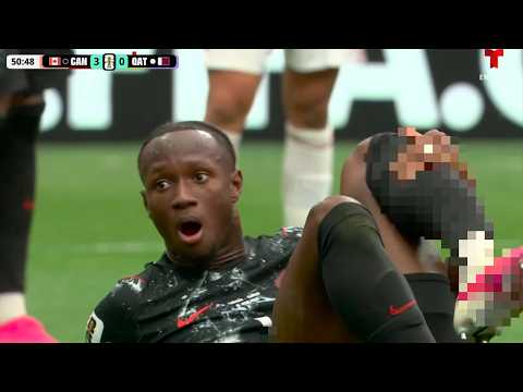 Thumbnail for Ismael Kone Breaks Leg at World Cup vs Qatar - Doctor Explains