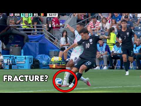 Thumbnail for Christian Pulisic Broke His Leg vs Belgium (Kind of) - Doctor Explains