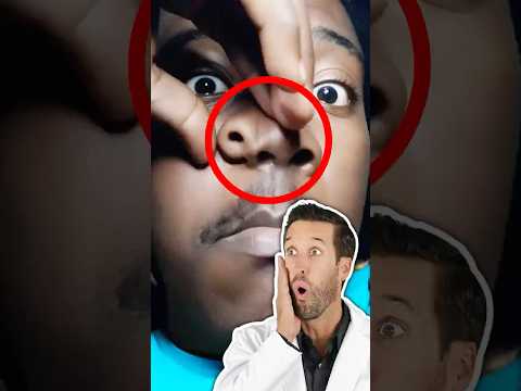 Thumbnail for ER Doctor REACTS to "Extra" Nose