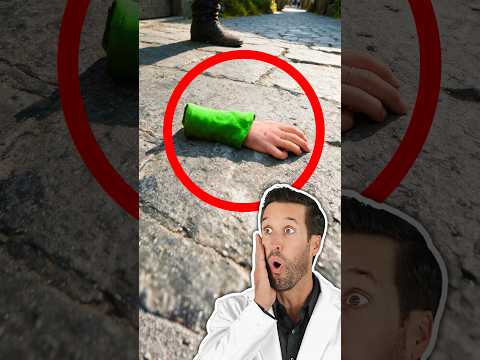 Thumbnail for ER Doctor REACTS to Arm "Removal" in House of the Dragon