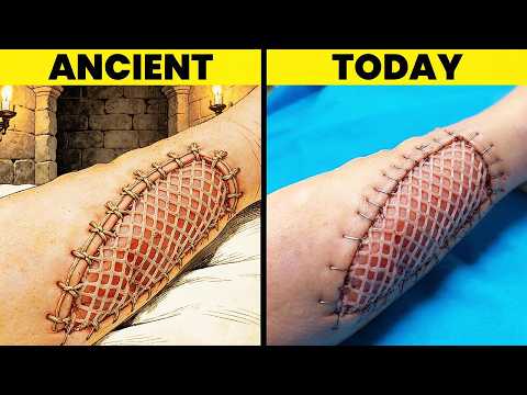 Thumbnail for 8 BRUTAL "Ancient" Medical Procedures Doctors Still Use Today (PART 2)