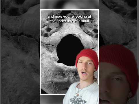 Thumbnail for This Skull Has A Secret