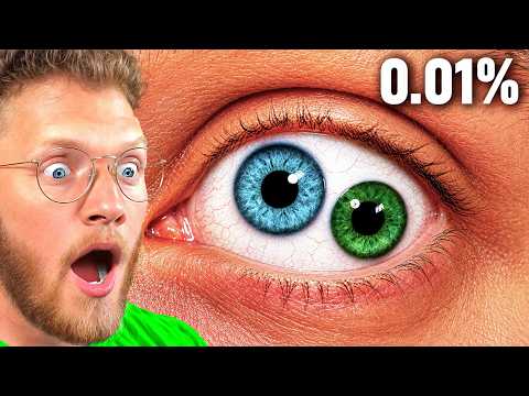 Thumbnail for Rarest Human Mutations